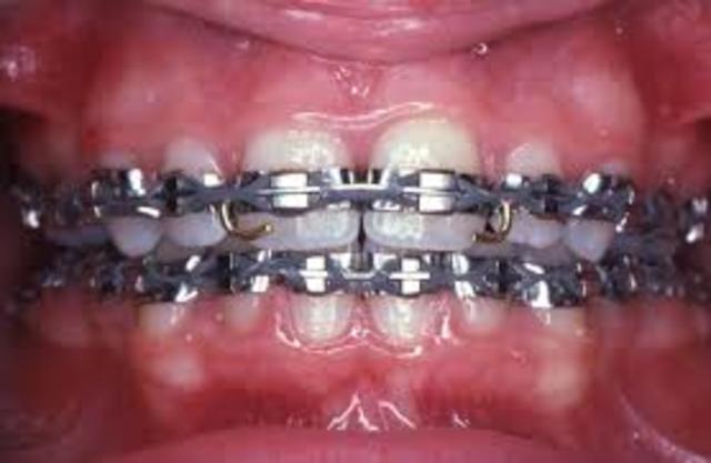 Brackets