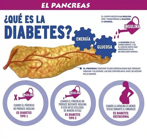 RELACIÓN ENTRE EL PANCREAS Y LA DIABETES