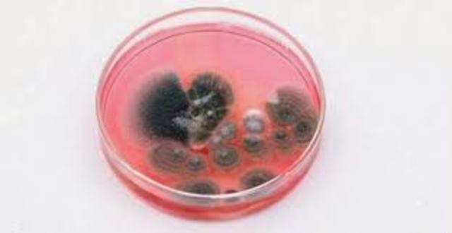 La formacion del hongo