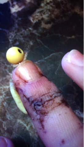 Broke my Middle Finger