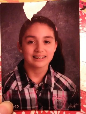 Right before I got my braces off