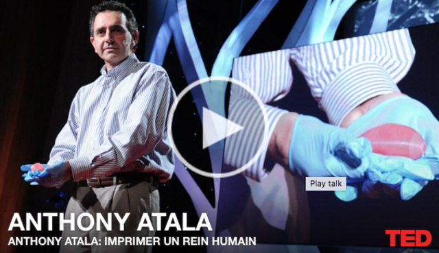 Greffe du premier rein artificiel imprimé en 3D