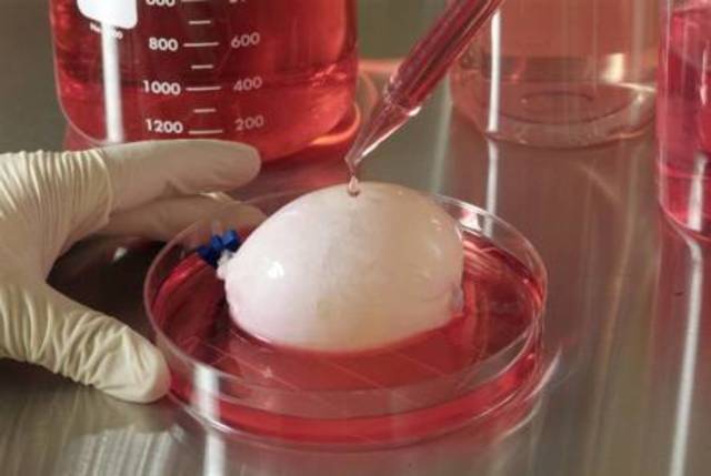 Primer trasplante de un órgano completo cultivado