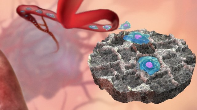 Dispositivo implantable debajo de la piel