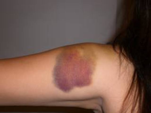 Nick's First Struggle With Caitlin