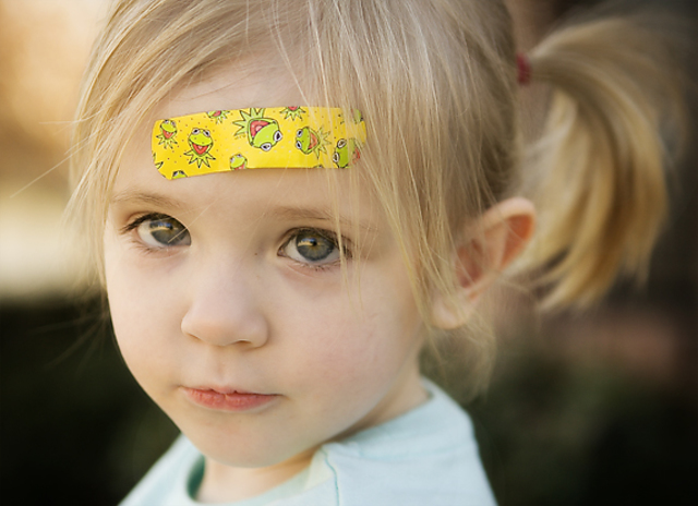 This boy beat me up at church and gave me a huge bruise on my forehead