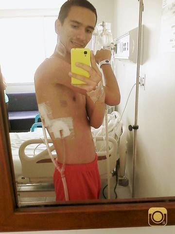 Cirugía del pulmón