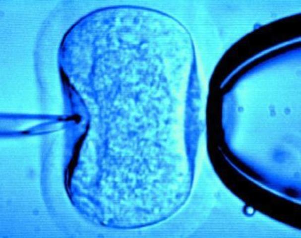 Robert Edwards y Patric Stetoe. Fecundación INVITRO. 1978.