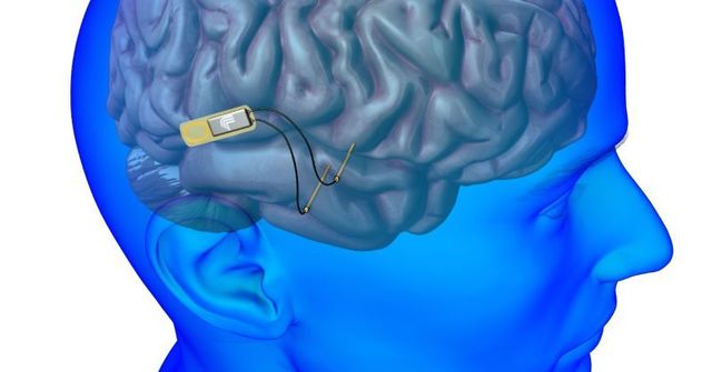 Plan para conectar el cerebro con los ordenadores.