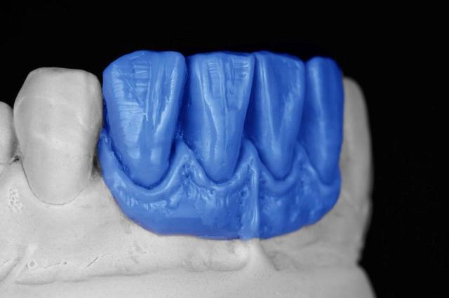 Acondicionamiento del tejido dentario