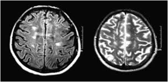 contraste intravenoso