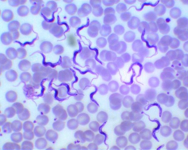 Trypanosoma brucei gambiense