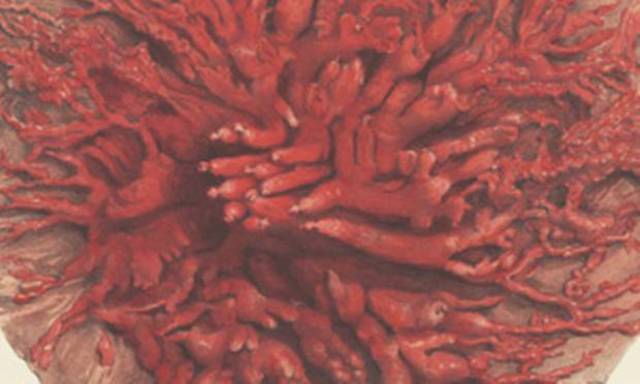 "Jeg æder mig selv som lyng" af Olga Ravn