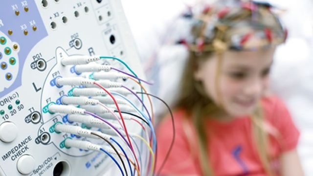 ELECTROENCEFALOGRAFÍA (Técnicas De Neuromarketing)