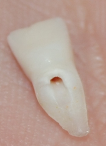 La caída de mi primer diente