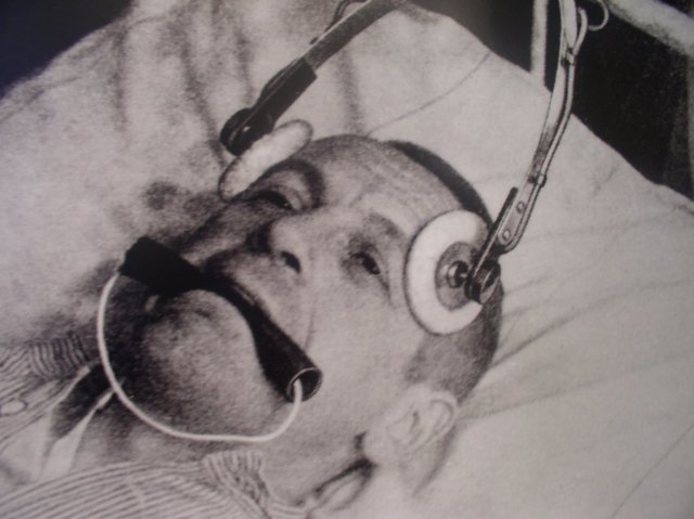 Electroconvulsive Shock Therapy