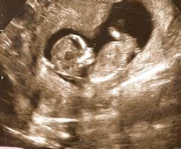 La gestation (0-11 mois)