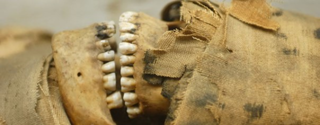 Early Signs of Dentist Work