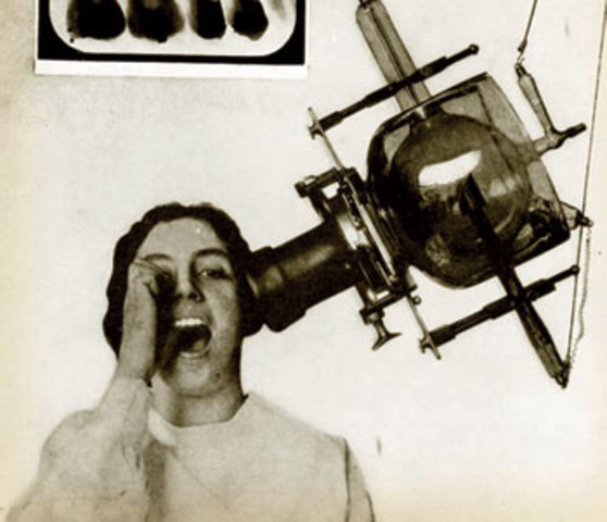 X-Rays Finally Used By Dentists