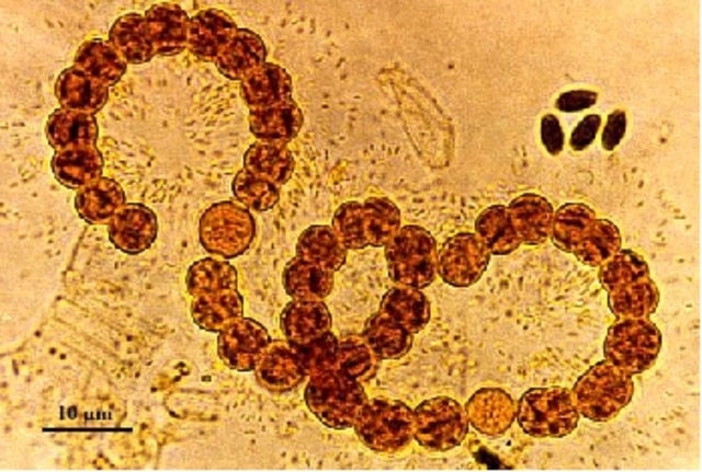Teoría Microbiana de la enfermedad