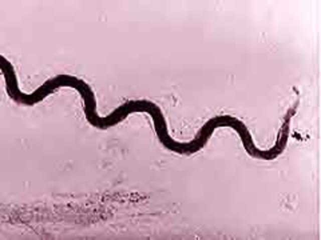 Programa mundial contra el pain