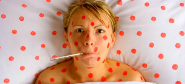 Lanzamiento de la Iniciativa de Lucha contra el Sarampión