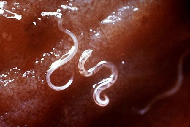 Dubii 1843 describe Ancylostoma duodenale  demostró que era la causa de anemia de los obreros