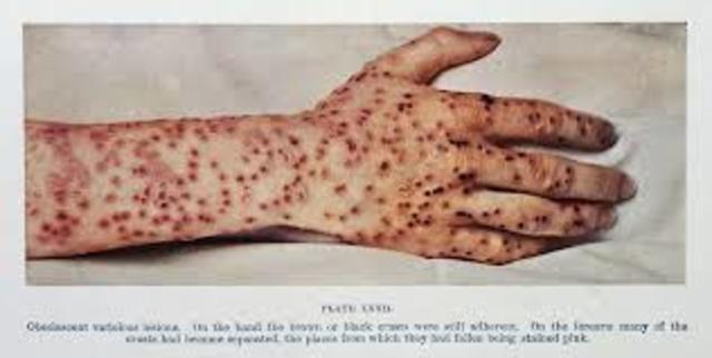 epidemic of smallpox