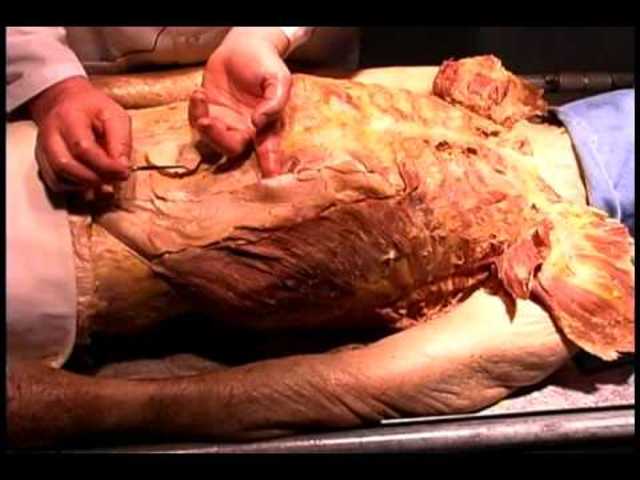 The First Legal Autopsy