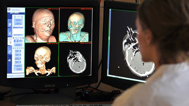 Virtual Autopsies