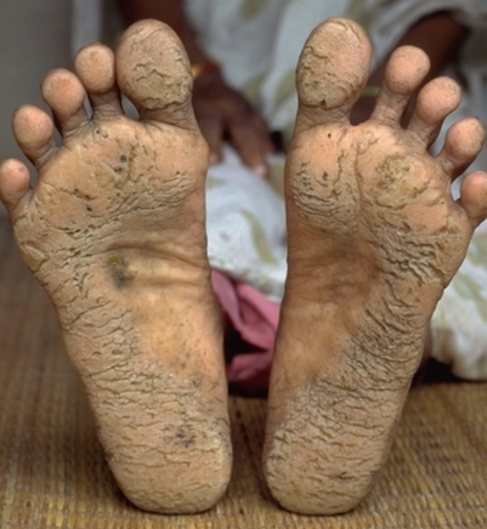 Chemical Testing used