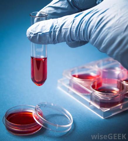 Investigating poisoning