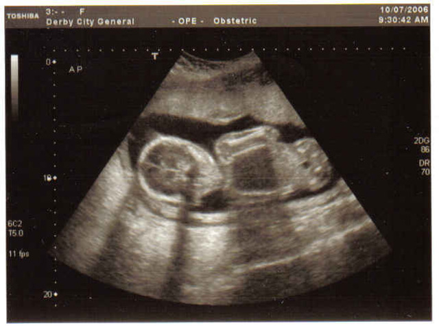 The day I was born..