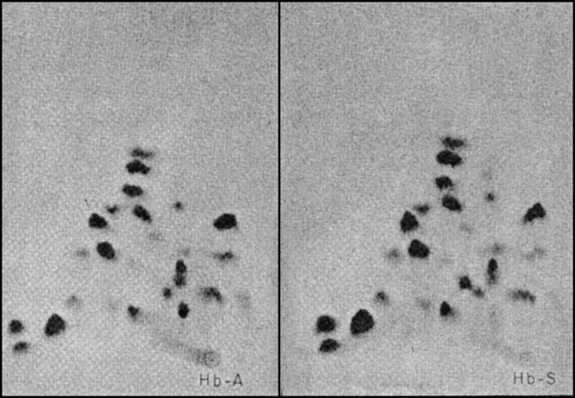 Sequencing Hemoglobin