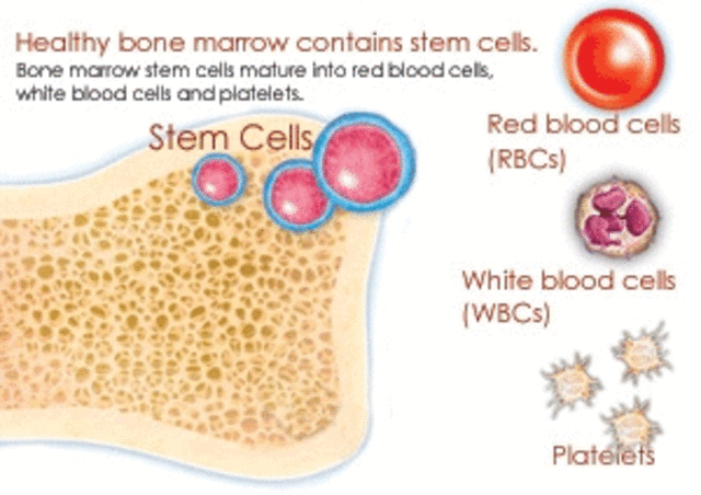 Cure for sickle cell disease