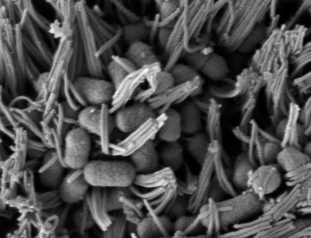 Enterohaemorrhagic Escherichia