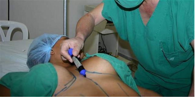 Cinco mujeres han muerto por cirugías plásticas este año en Medellín