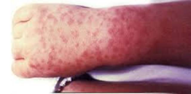 Field Study 1910-1911