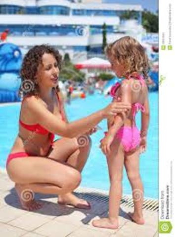 when i got a sunburn