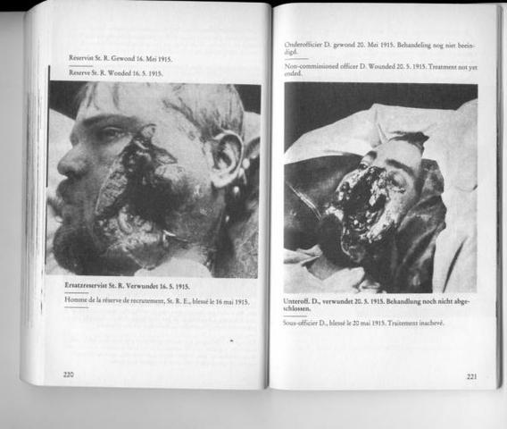 German pacifict Ernst Friedrich's "Krieg dem Kriege!" is published for the first time, later becoming a "pacifist bible" that rallies the movement under slogan "no more war." The book records human costs of war and uses images from the First World War.