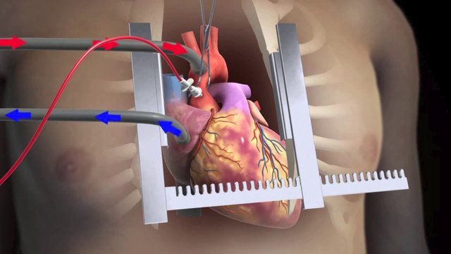 Ferdinand Sauerbruch, desarrolló la cámara de baja presión, con la que posibilitó las operaciones a tórax abierto.
