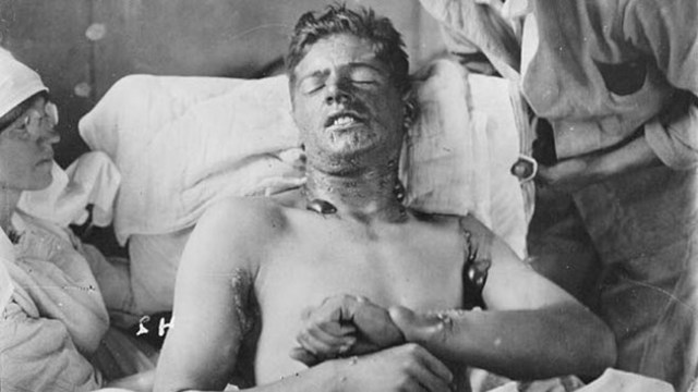 Ypres - az első éles bevetés