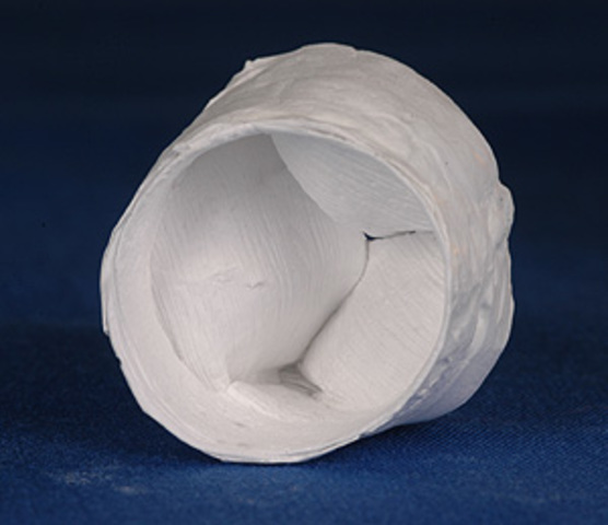 Se crean las válvulas cardiacas artificiales