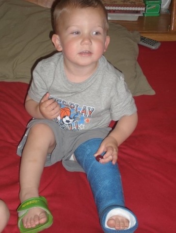 Cole broke his leg on our trampoline.