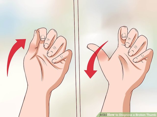 when i had broke my thumb