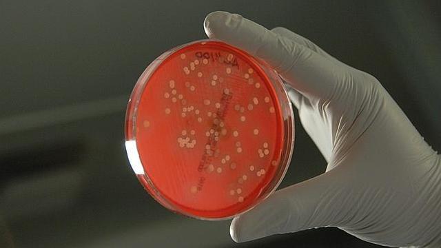 Estudio de bacterias.