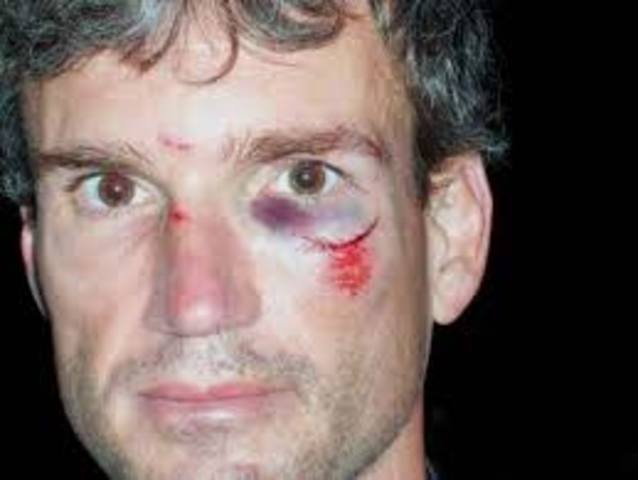 The day i cut my cheeck under my eye open