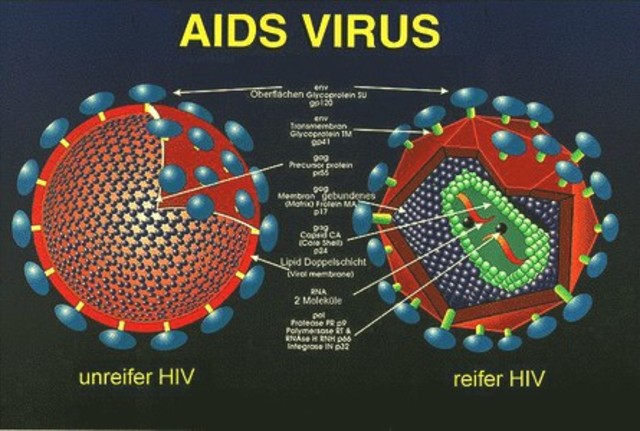 AIDS discovery!