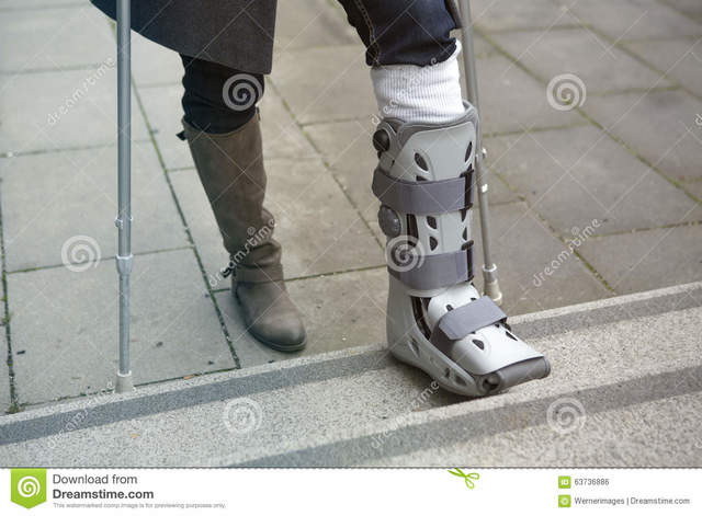 The Time i broke my foot