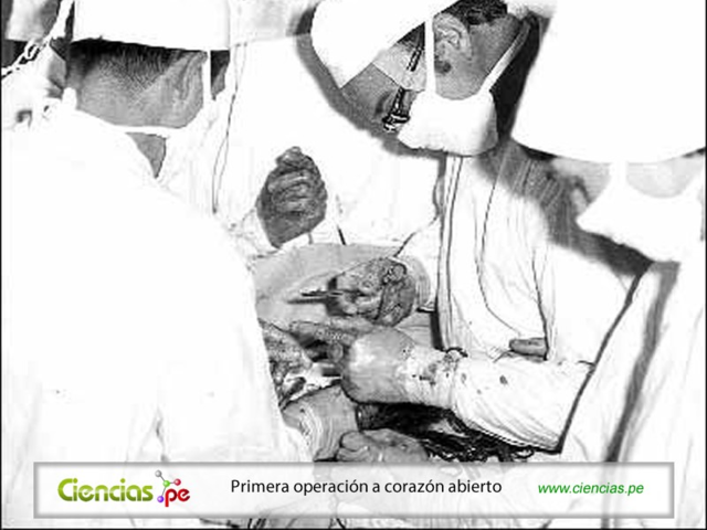 Primera Operación a corazón abierto